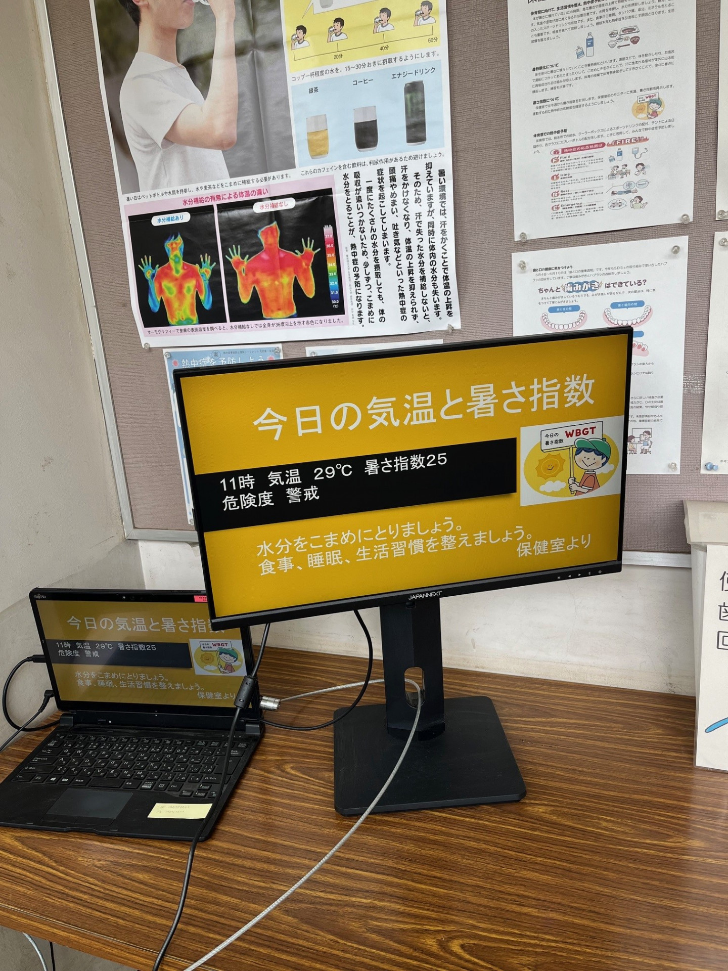 モニター