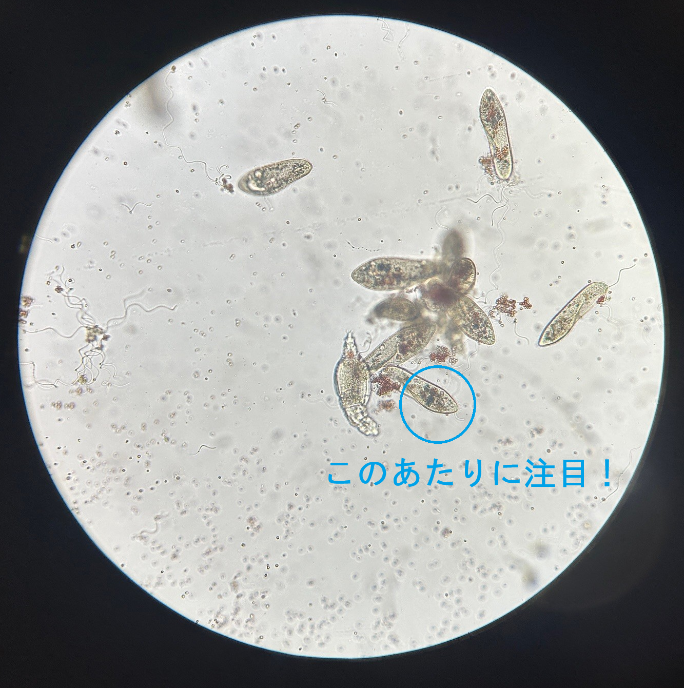 ゾウリムシの消化